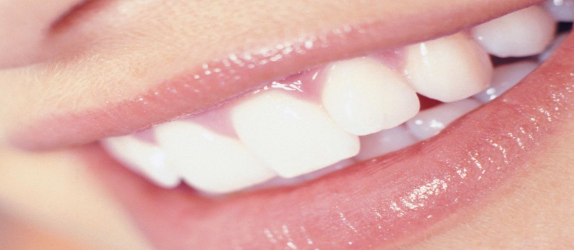 Blancorexia,-la-obsesión-por-unos-dientes-muy-blancos-1920