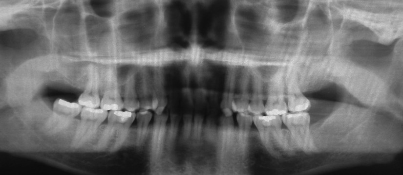 Las-radiografías-dentales-1920